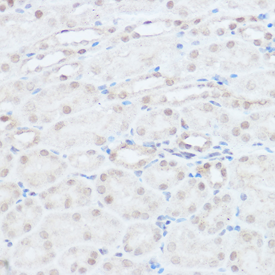 NEDD9 Rabbit polyclonal antibody