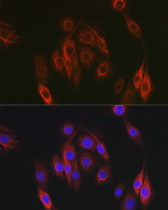 NEDD9 Rabbit polyclonal antibody