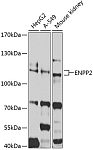 Western blot - ENPP2 Rabbit pAb (A2522)