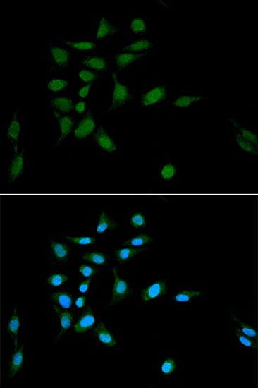 PSMA1 Rabbit polyclonal antibody