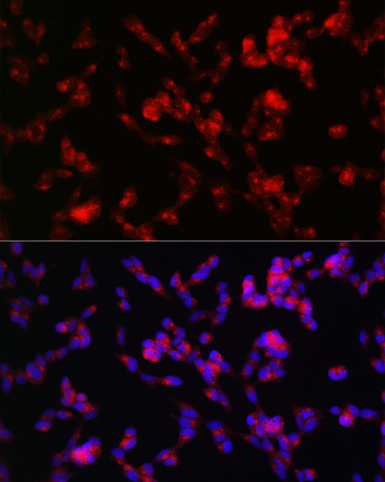 ADAMTS4 Rabbit polyclonal antibody