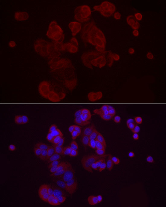 DKK3 Rabbit polyclonal antibody