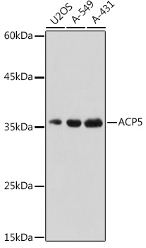 ACP5 Rabbit polyclonal antibody