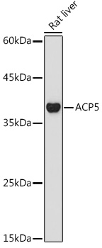 ACP5 Rabbit polyclonal antibody