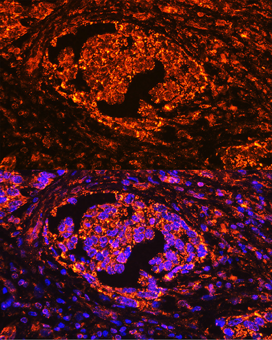 ACP5 Rabbit polyclonal antibody