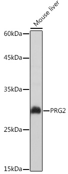 PRG2 Rabbit polyclonal antibody
