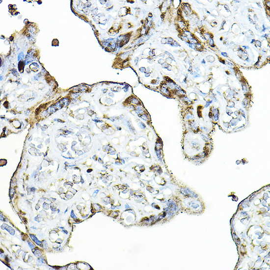 PRG2 Rabbit polyclonal antibody