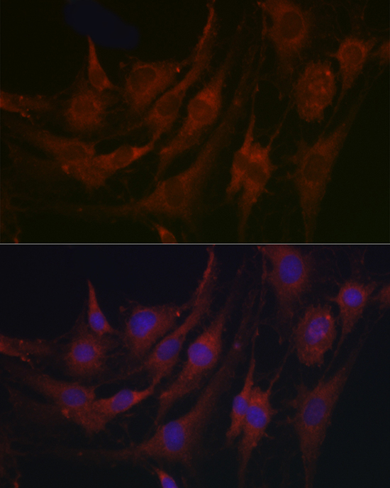 PRG2 Rabbit polyclonal antibody