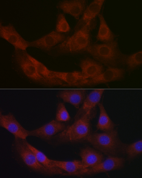 PRG2 Rabbit polyclonal antibody
