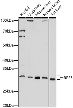 RPS3 Rabbit polyclonal antibody