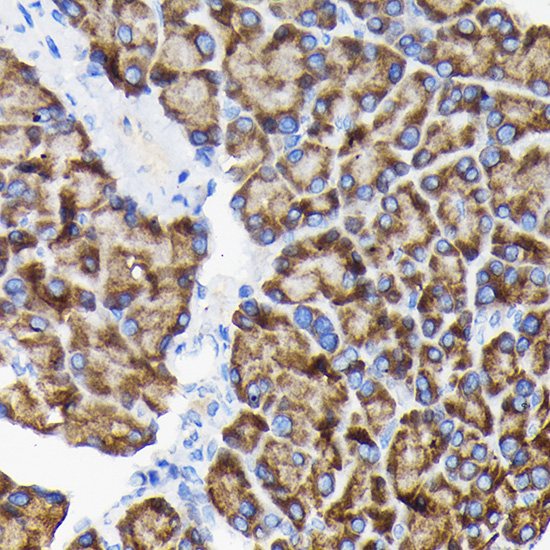 RPS3 Rabbit polyclonal antibody