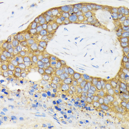 RPS3 Rabbit polyclonal antibody