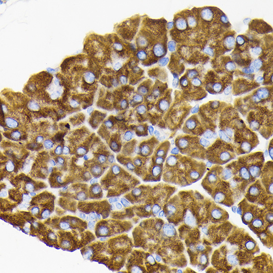 RPS3 Rabbit polyclonal antibody