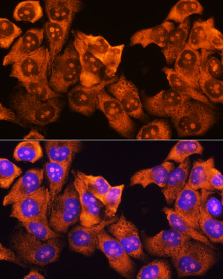 RPS3 Rabbit polyclonal antibody