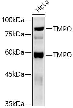 TMPO Rabbit polyclonal antibody
