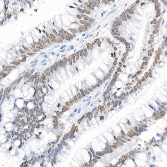 TMPO Rabbit polyclonal antibody