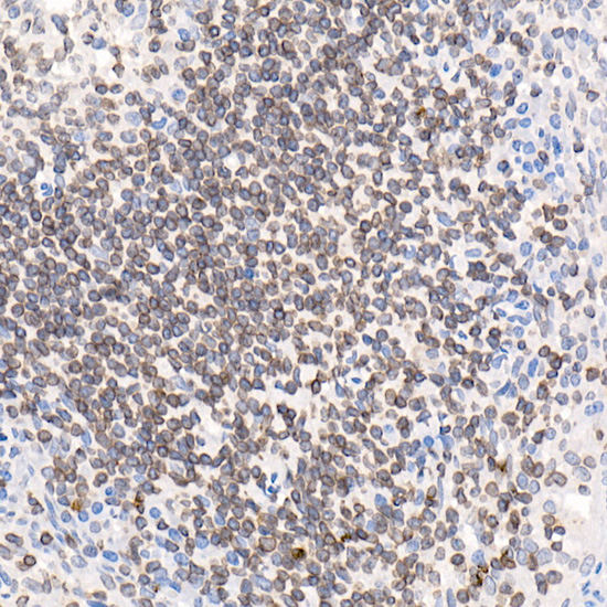 TMPO Rabbit polyclonal antibody