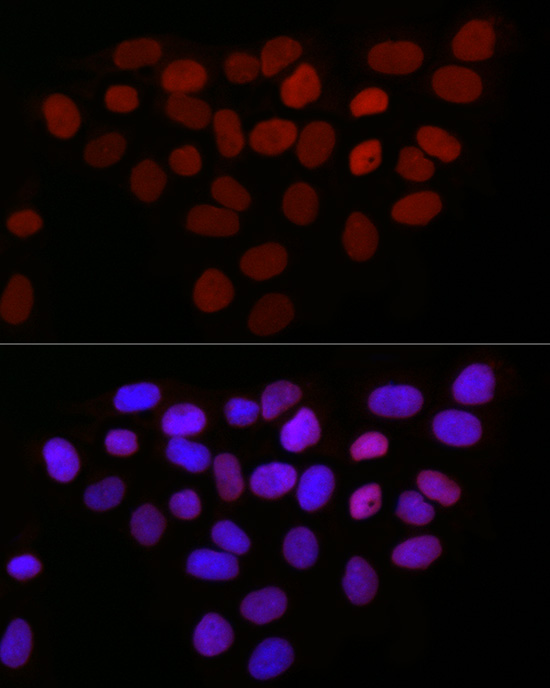 TMPO Rabbit polyclonal antibody