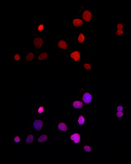 TMPO Rabbit polyclonal antibody