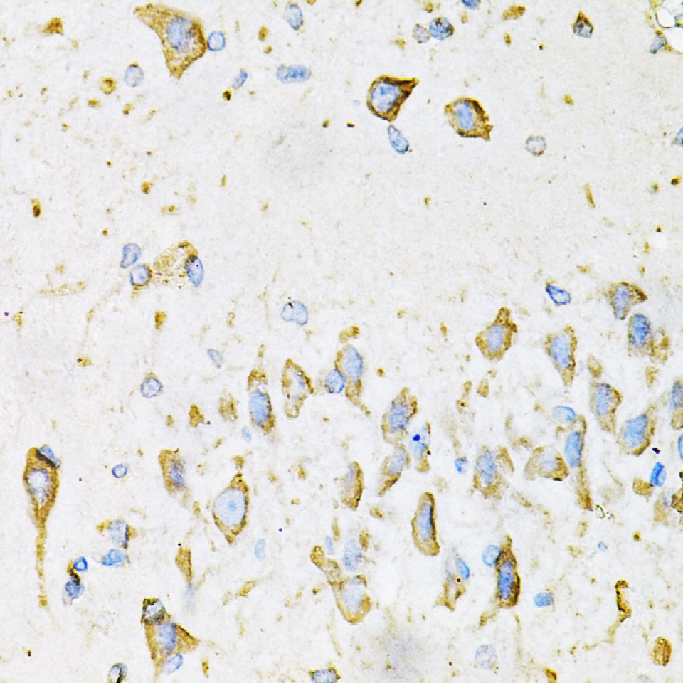 Adiponectin Rabbit polyclonal antibody