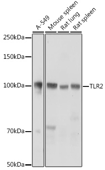 TLR2 Rabbit polyclonal antibody