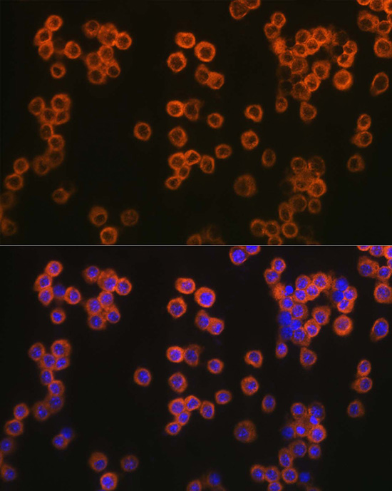 TLR2 Rabbit polyclonal antibody