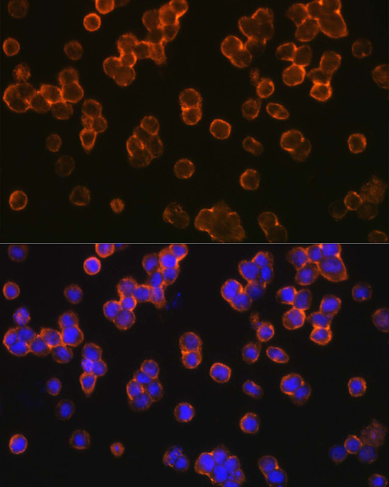 TLR2 Rabbit polyclonal antibody