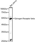 Western blot - Estrogen Receptor beta Rabbit pAb (A2546)