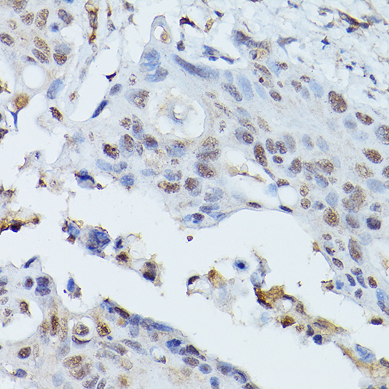 PLK1 Rabbit polyclonal antibody