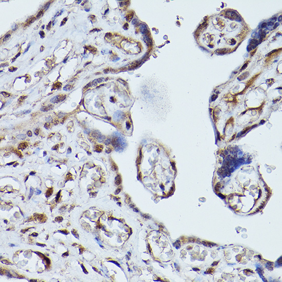 PLK1 Rabbit polyclonal antibody