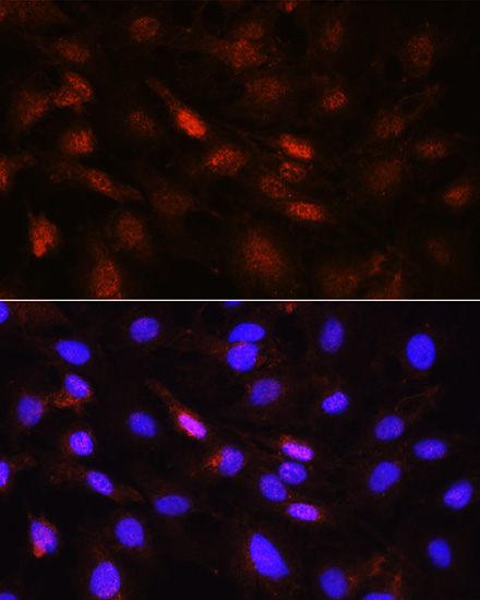 PLK1 Rabbit polyclonal antibody