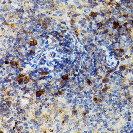 Granzyme B Rabbit polyclonal antibody