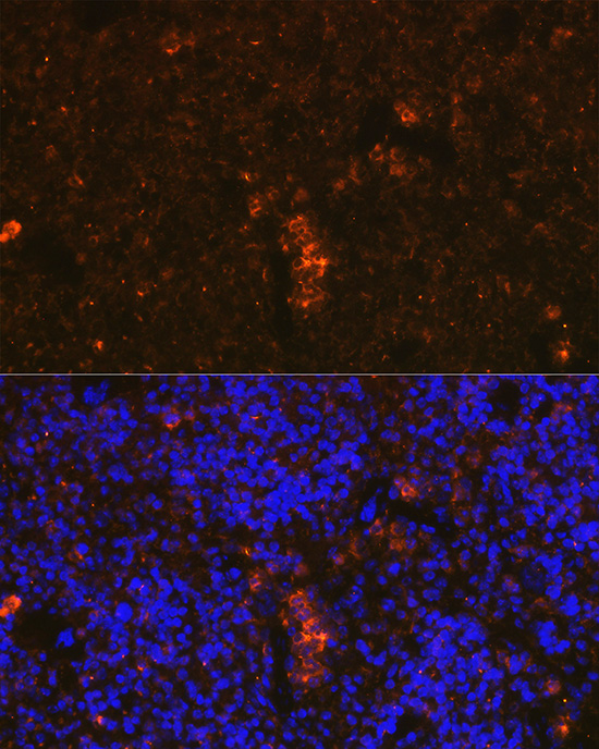 Granzyme B Rabbit polyclonal antibody
