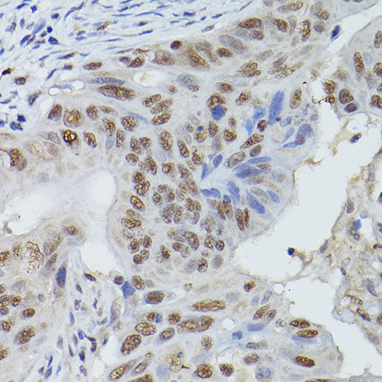 MRE11 Rabbit polyclonal antibody