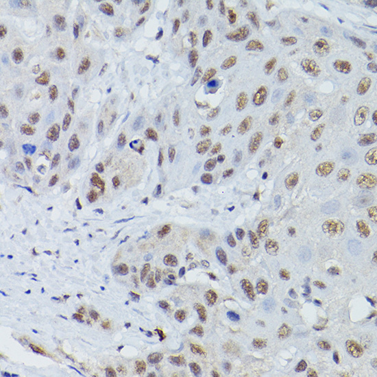 MRE11 Rabbit polyclonal antibody