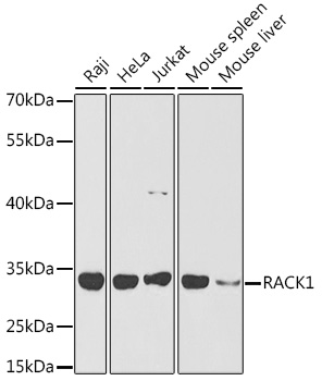 RACK1 Rabbit polyclonal antibody