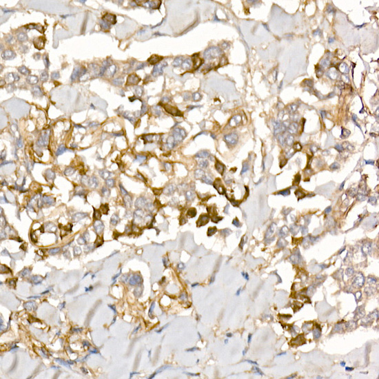 TGF beta induced (TGFBI) Rabbit polyclonal antibody