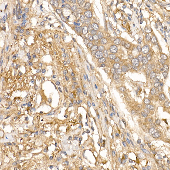 TGF beta induced (TGFBI) Rabbit polyclonal antibody