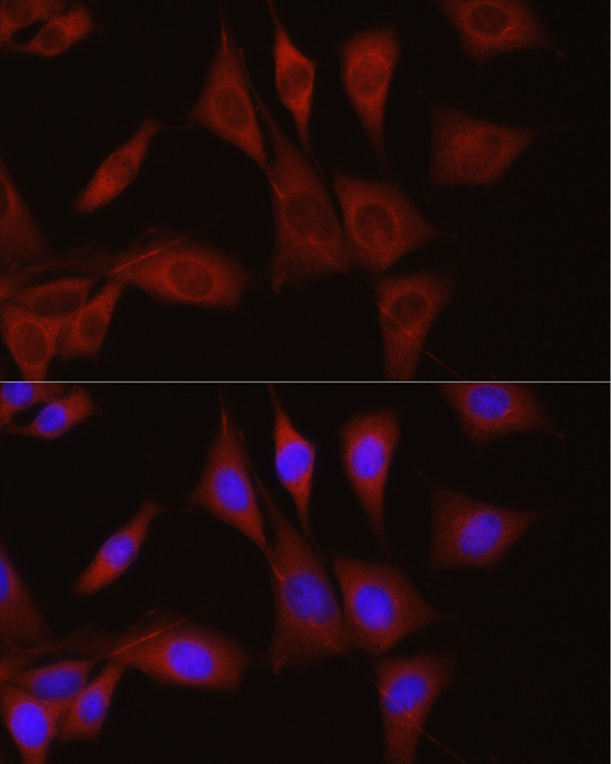 TGF beta induced (TGFBI) Rabbit polyclonal antibody