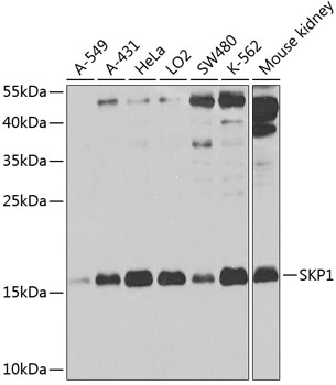 SKP1 Rabbit polyclonal antibody