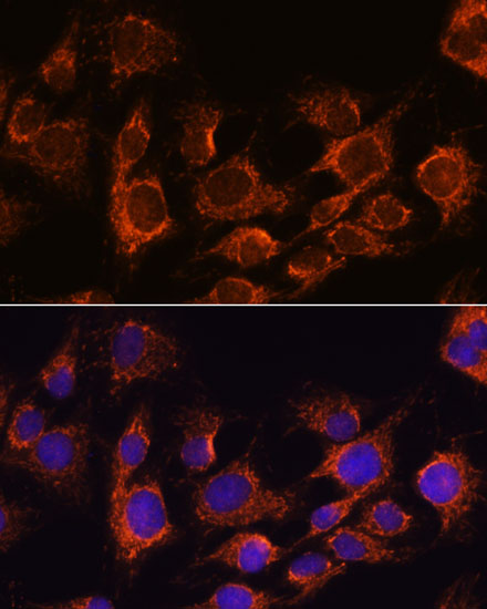 [KO Validated] AIF Rabbit polyclonal antibody