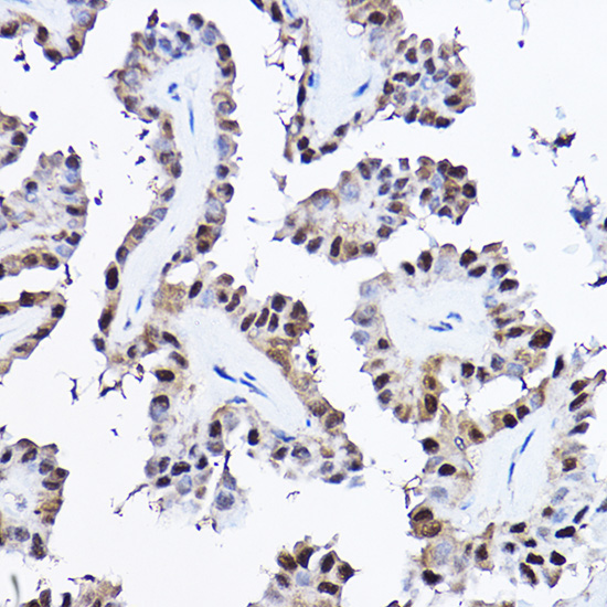 [KO Validated] PDCD4 Rabbit polyclonal antibody