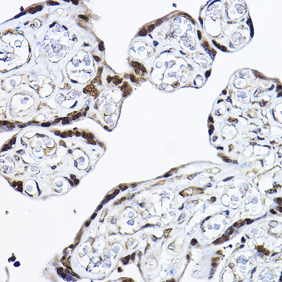 [KO Validated] PDCD4 Rabbit polyclonal antibody