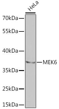 MEK6 Rabbit polyclonal antibody