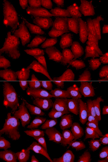 MEK6 Rabbit polyclonal antibody