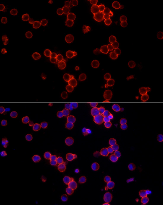 CD19 Rabbit polyclonal antibody