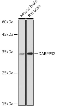 DARPP32 Rabbit polyclonal antibody