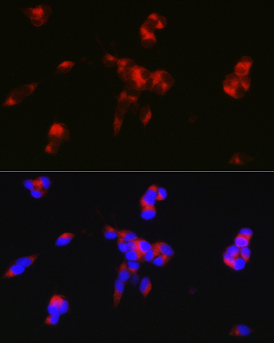 DARPP32 Rabbit polyclonal antibody
