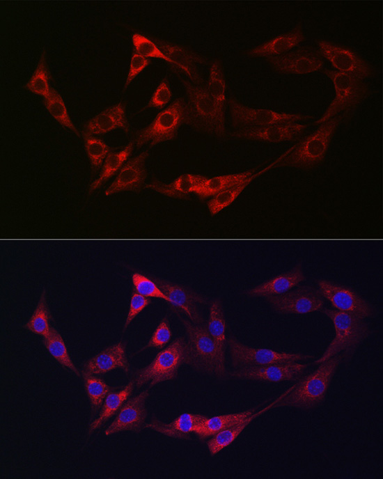 NRP2 Rabbit polyclonal antibody