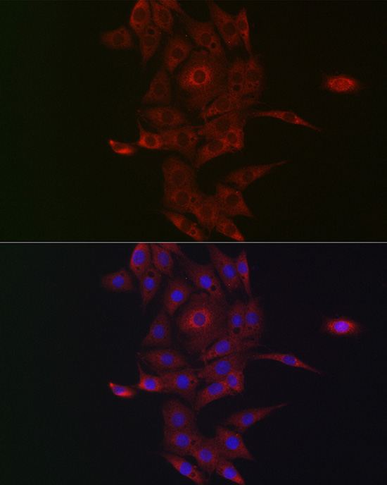 NRP2 Rabbit polyclonal antibody